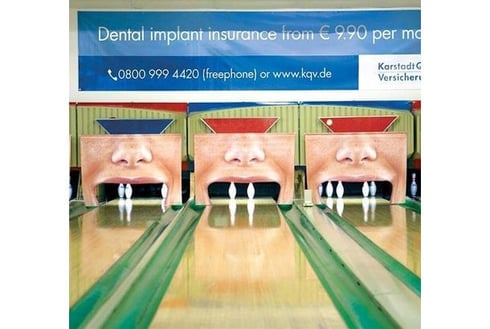 歯科インプラントの広告！