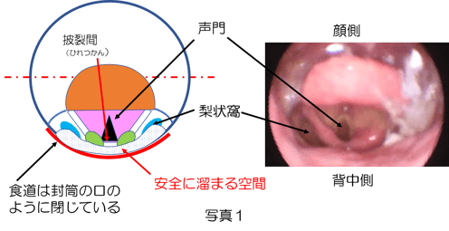 仰臥位では、一口スプーンの3㏄が溜まるところは気管の入り口近いことが分かる