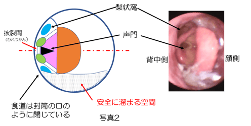 完全側臥位では、気管の入り口より遠いところに15~20㏄溜まる