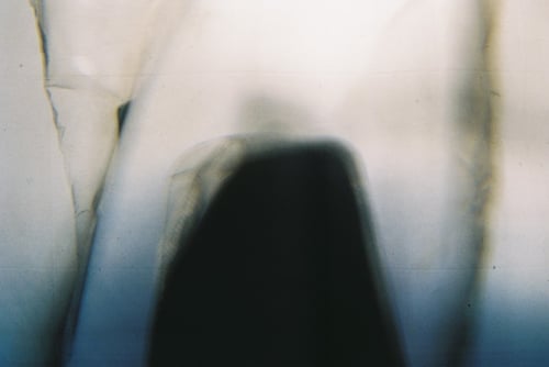 YLOP - OHUM©stephan brenn