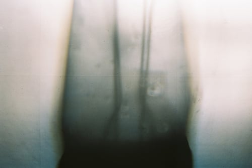 YLOP - ADORN©stephan brenn