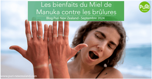 Femme qui montre ses mains qui a un coup de soleil sur une plage