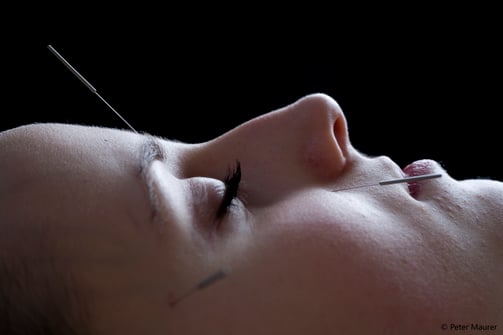 Akupunktur Praxis Sabina Tundo Kriens und Zürich