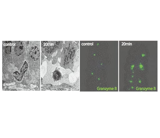 東北大学器官解剖学　研究