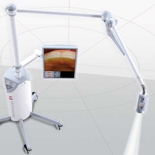 3D-Dentaloscope / SMT (CH)