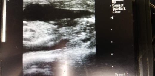 Gestation de 3 mois. La tête est à droite sur la photo. Vue dorsale.