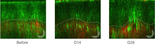 表皮と真皮の接合部の観察画像