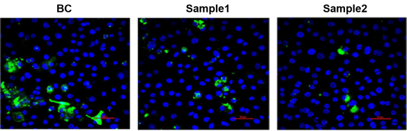 メラノソームの輸送阻害によるメラニン蓄積の抑制作用評価試験の画像