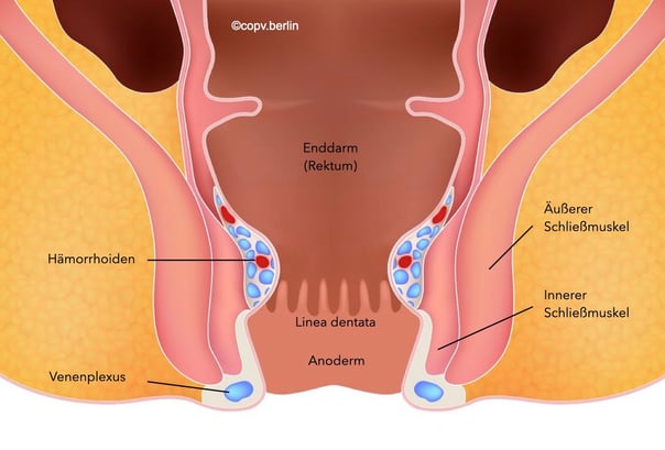 Enddarm mit Hämorrhoiden - COPV Berlin Proktologie
