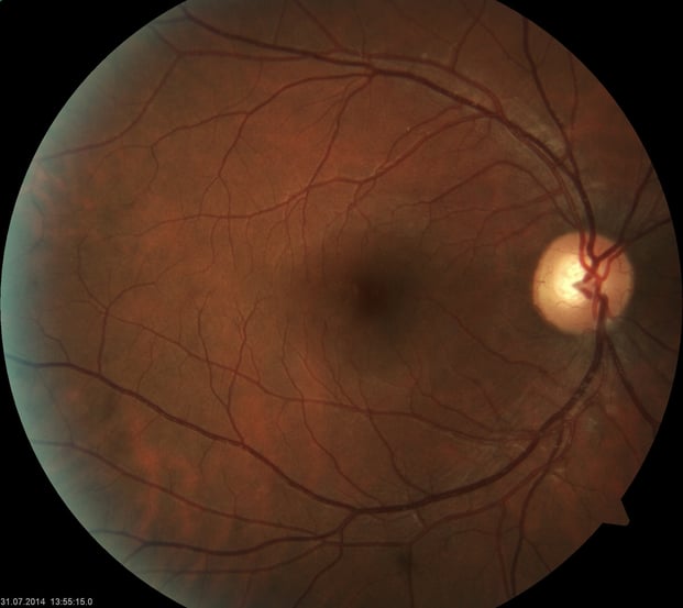 Das Auge des Autors, aufgenommen im Ars Electronica Center Linz.