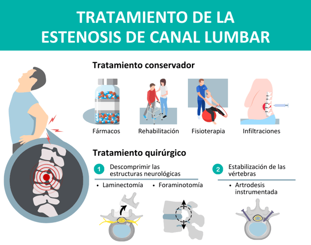 Tratamiento conservador y fisioterapia en las hernias discales y estenosis de canal
