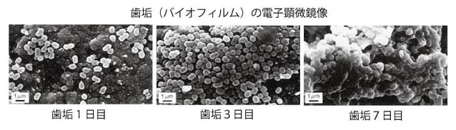 歯垢(バイオフィルム）の電子顕微鏡像