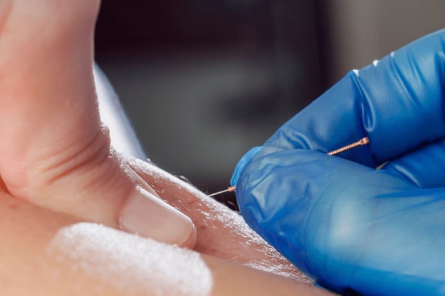 Dry Needling Basel Stadt