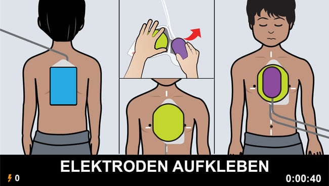 ZOLL AED 3 Kinder-Modus