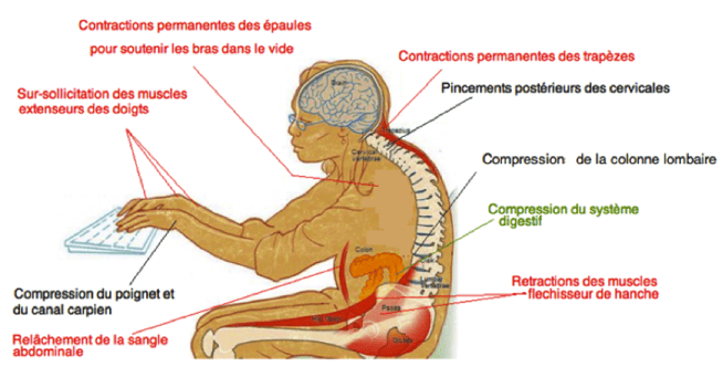 mauvaise posture ordinateur ostéopathe arènes toulouse