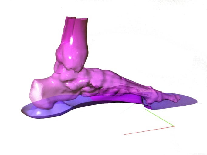 exakte Modellierung an 3D Fuß
