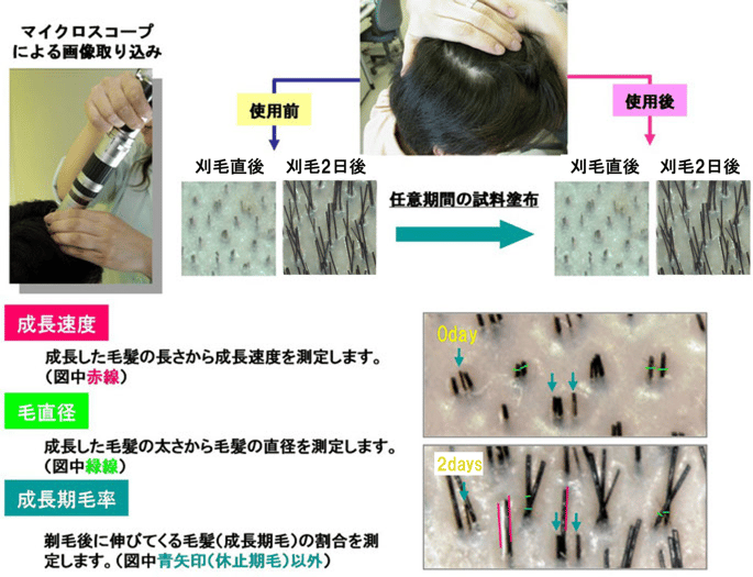 フォトトリコグラム