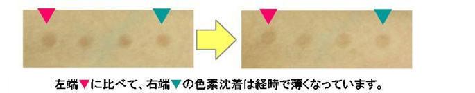 シミを有するボランティアに対する色素沈着抑制作用評価