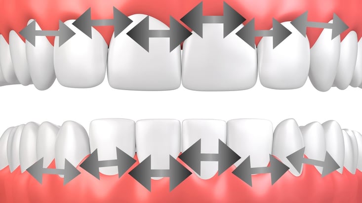 ParoSphère | La technique de Bass. Crédit photo: © yodiyim.