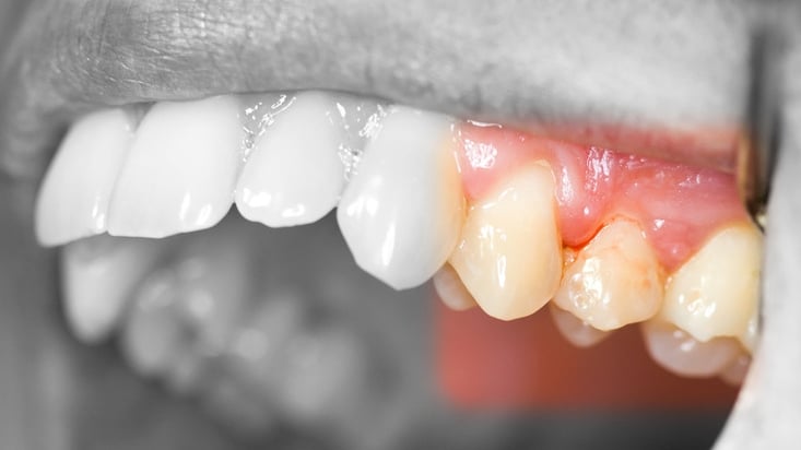 © Zsolt Bota Finna - Fotolia.com