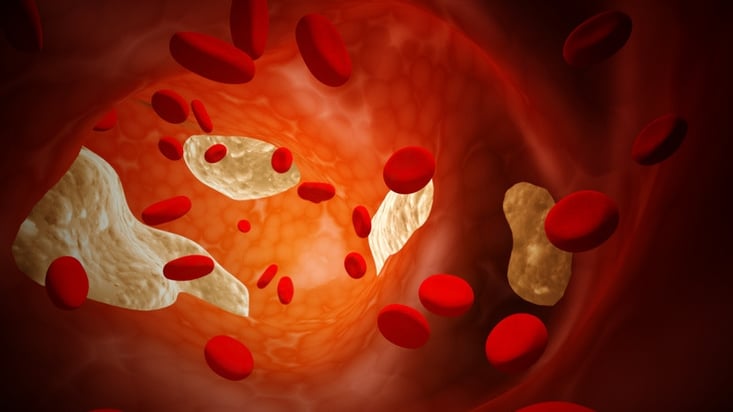 © frenta - Fotolia.com