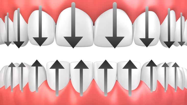 ParoSphère | La technique du rouleau simplifiée. Crédit photo: © yodiyim.