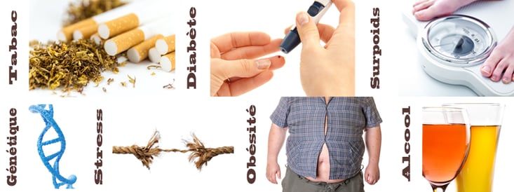 Facteurs de risque des parodontites ©ParoSphère 