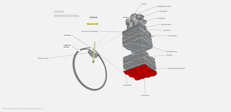 Schematische Darstellung der Schichten der Hornhaut, die bei einer DMEK ausgetauscht werden.
