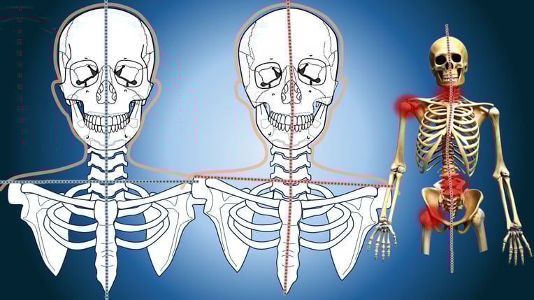 噛み合わせや歯の治療で顎がズレる