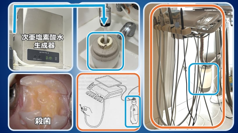 ボトルシステムでユニット内に殺菌水を流し、歯を治療中にも殺菌