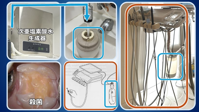 ボトルシステムで次亜塩素酸水を流し、治療中の感染予防を確実にします。