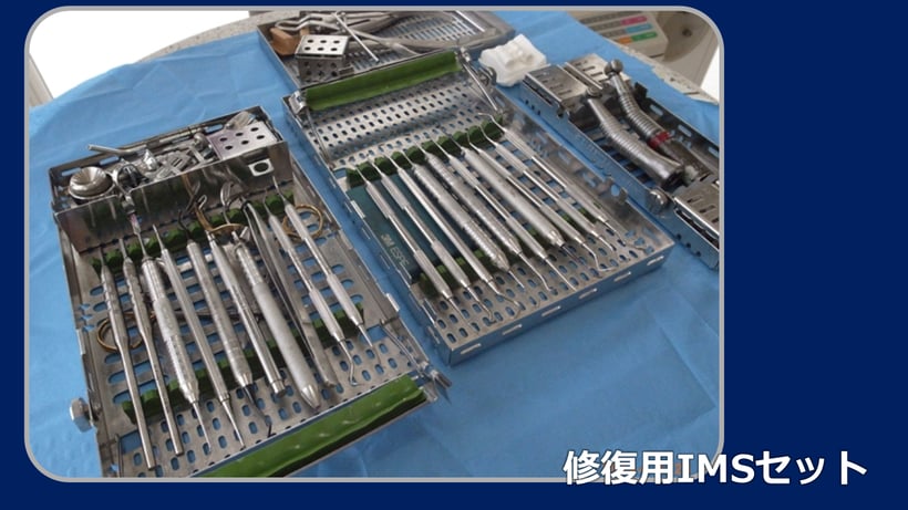 修復に必要な器具が一つのカセッテに全て入っているのでピッキングの必要がありません。
