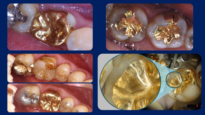ゴールド修復、いずれもJRVT