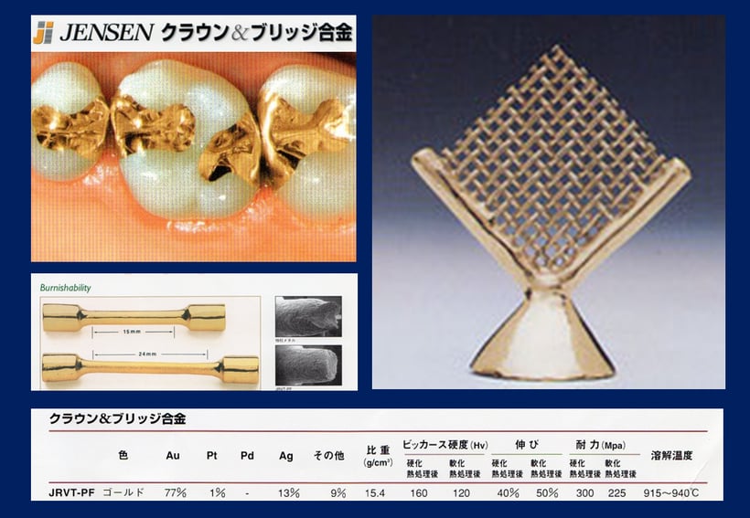 優れた物性を持つ最高のゴールド修復材