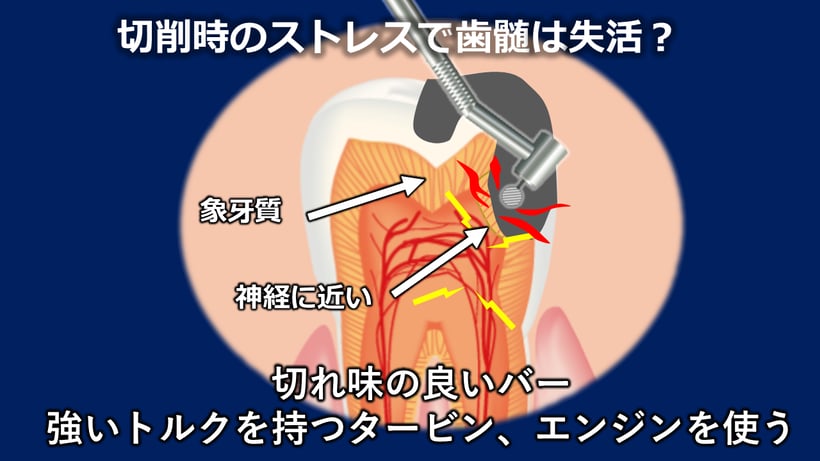 歯の治療では神経に近い治療の場合熱刺激を最小限にしないと神経が失活する可能性があることを示す図。