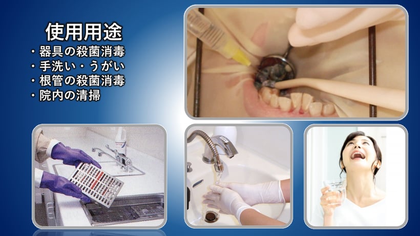 次亜塩素酸水の使用用途、使用例、根管治療の洗浄、手洗い、うがい、滅菌できないものの殺菌消毒