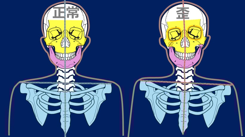 顎が左右にゆがむと、肩甲骨、鎖骨、胸骨が歪む