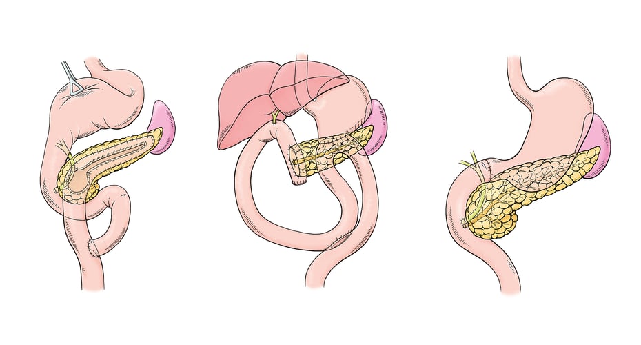 Drei von insgesamt zwölf Visualisierungen © Michael Stünzi