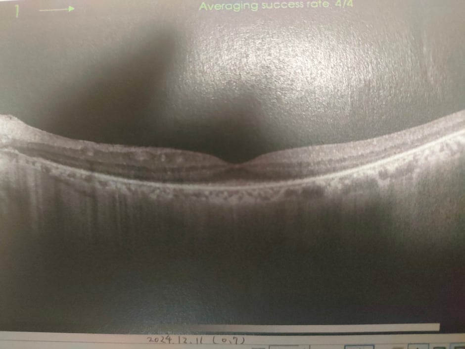2024年12月11日　矯正視力０，７