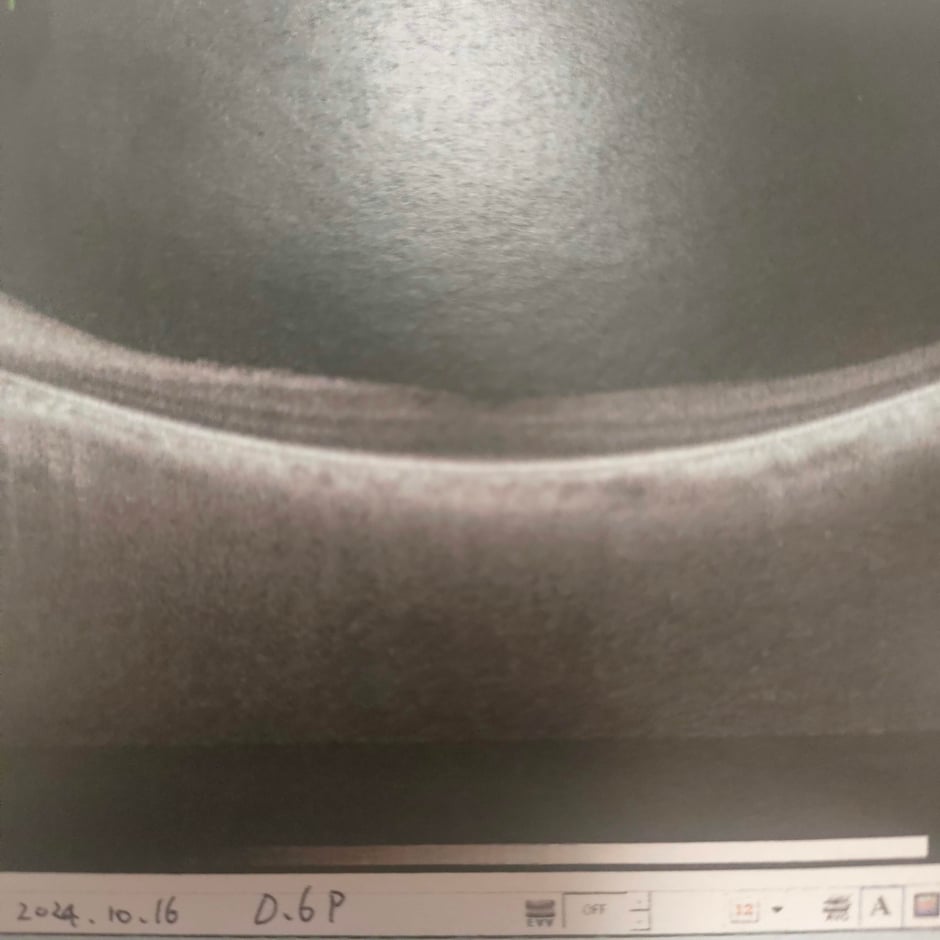 2024年10月16日　矯正視力０，６P