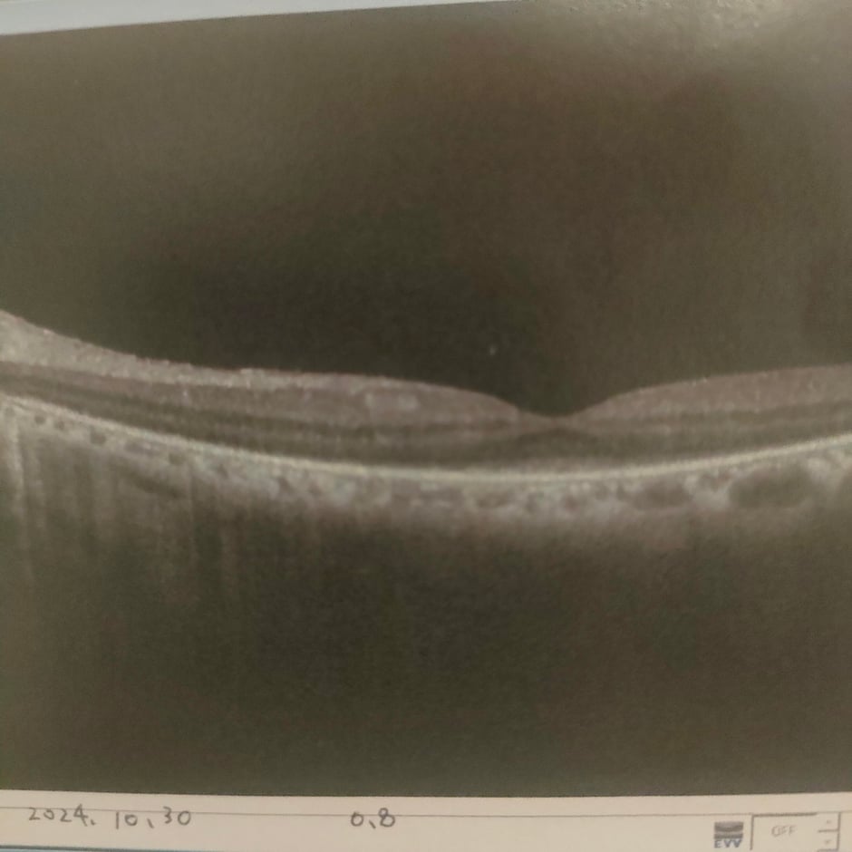 2024年10月30日　矯正視力０，８