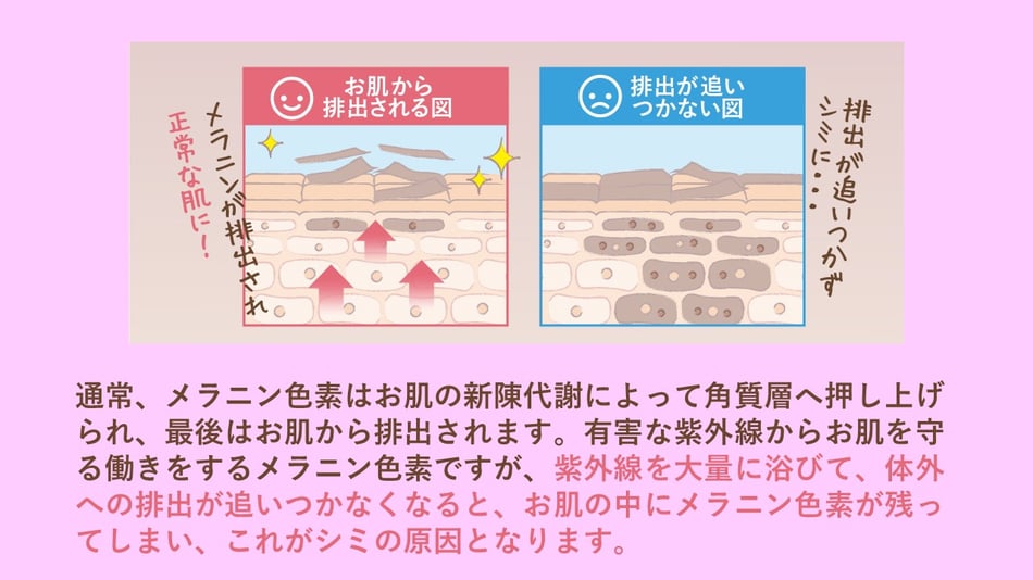 お肌から排出される図　排出が追いつかない図　通常、メラニン色素はお肌の新陳代謝によって角質層へ押し上げられ、最後はお肌から排出されます。有害な紫外線からお肌を守る働きをするメラニン色素ですが、紫外線を大量に浴びて、体外への排出が追いつかなくなると、お肌の中にメラニン色素が残ってしまい、これがシミの原因となります。