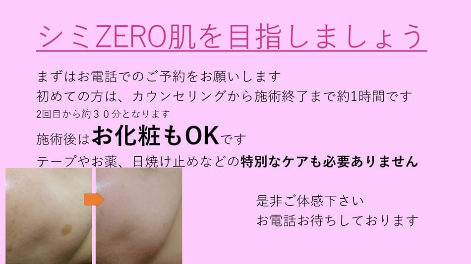 シミZERO肌を目指しましょう　まずはお電話でのご予約をお願いします。　初めての方は、カウンセリングから施術終了まで１時間です。２回目から約３０分となります。施術後はお化粧もOKです。テープやお薬、日焼け止めなどの特別なケアも必要ありません。是非ご体感下さい。お電話お待ちしております。