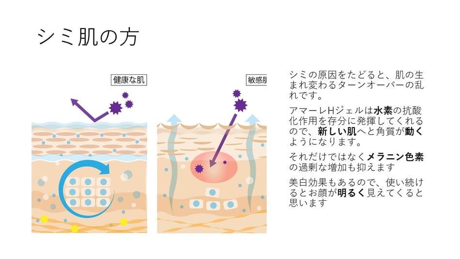 シミの原因をたどると、肌の生まれ変わるターンオーバーの乱れです。アマーレHジェルは水素の抗酸化作用を存分に発揮してくれるので、新しい肌へと角質が動くようになります。それだけではなくメラニン色素の過剰な増加も抑えます。美白効果もあるので、使い続けるとお肌が明るく見えてきます。